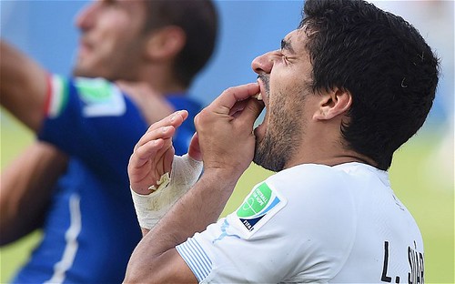 luissuarez_2957847b